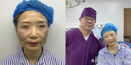 ITA:49岁阿姨拉皮后像少女，但她却说，不要轻易做拉皮！